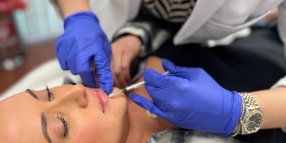 Cosmetic Filler in Doral, FL - FaceBeauty Med Spa